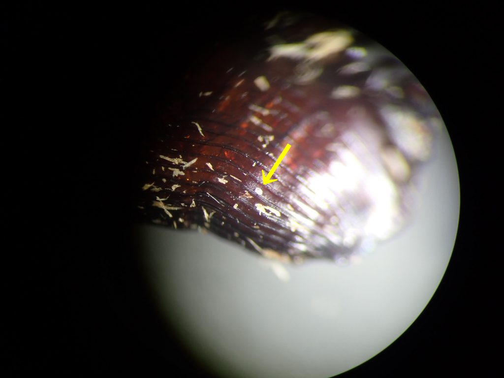 ダニ類 ねずみ 害虫 シロアリ駆除ならシー アイ シー ダニ類 ねずみ 害虫 シロアリ駆除ならシー アイ シー